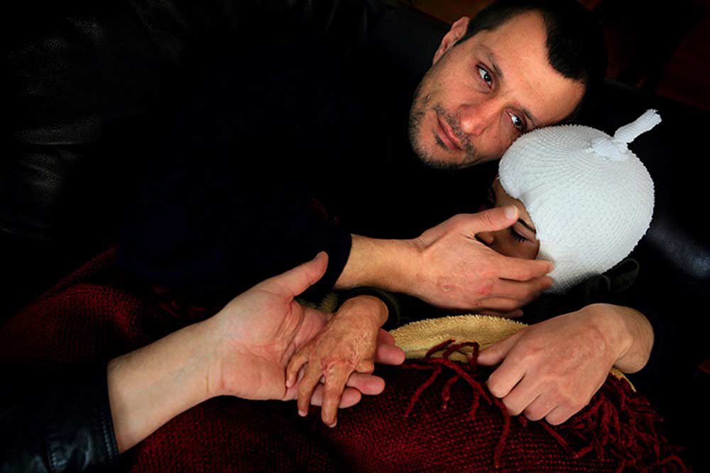 Waking up in pain the day after surgery, Omar is soothed by his father's touch. Omar will undergo at least another year of reconstructive surgery before returning to Iraq. © Copyright Liz O. Baylen